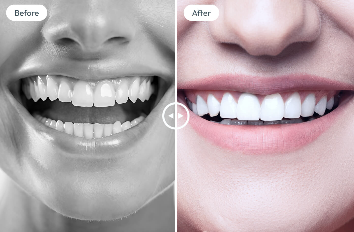 before-after results