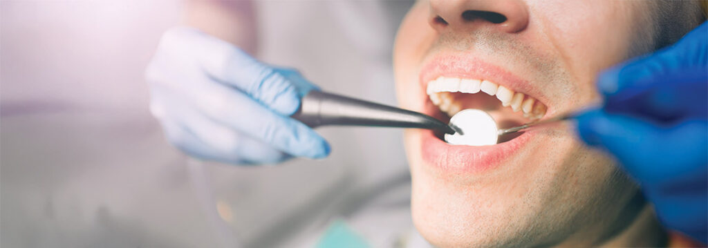 Myth About Cosmetic Dentistry